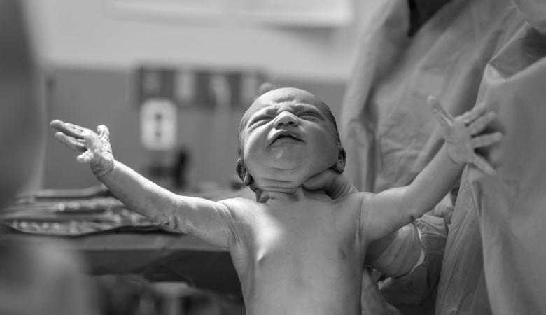 Newborn in Doctor's Arms | Birth Injuries