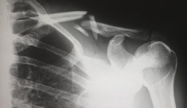 Medical X-ray