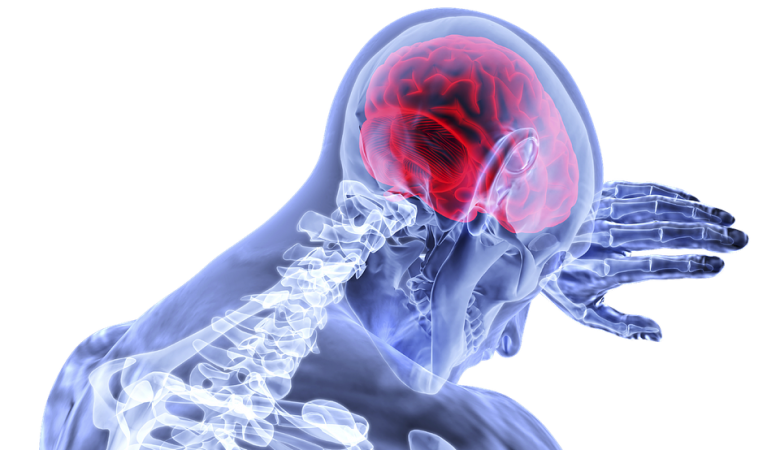 X-ray Image of Brain | Medical Negligence